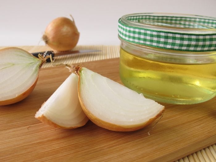 Onion/Shallot Juice for Hair: Benefits & How to Make